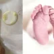 https://www.lokmattimes.com/health/8-month-old-baby-swallows-bottle-cork-bluru-doctors-successfully-operate/