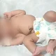 Baby girl with Four Legs Born in Madhya Pradesh