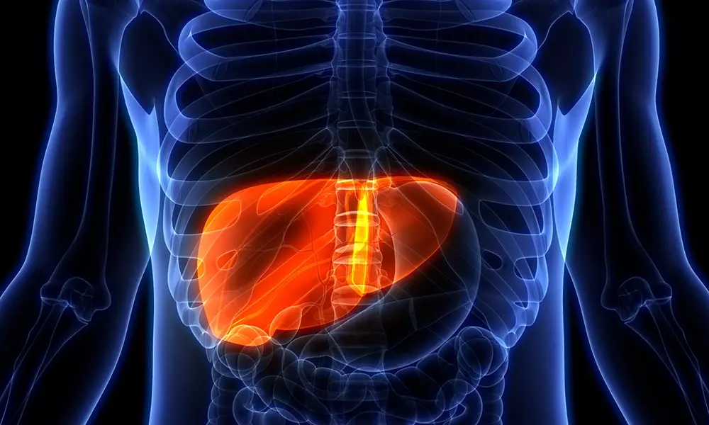 Fatty liver disease 