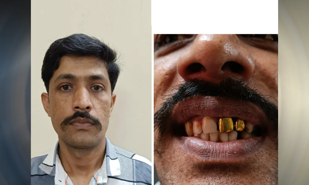 Gold Teeth Criminal