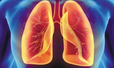 Herbs That Improve Lung Health