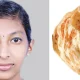 Girl Died After Eat Parotta In Kerala