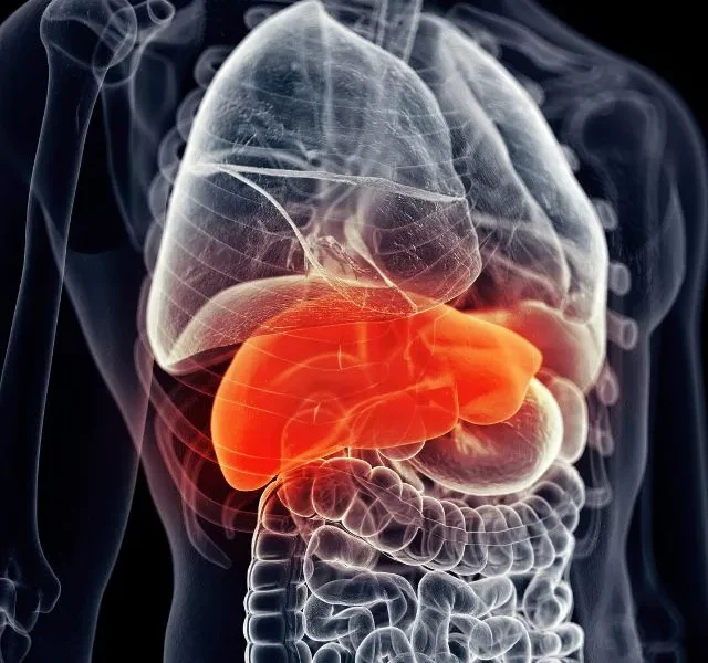 Fatty Liver Disease 6