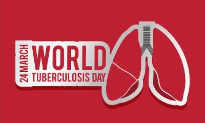 What precautions are necessary to prevent tuberculosis?