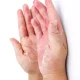 Dry Hands