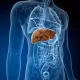 Fatty Liver Disease