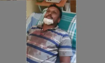 jds worker assaulted