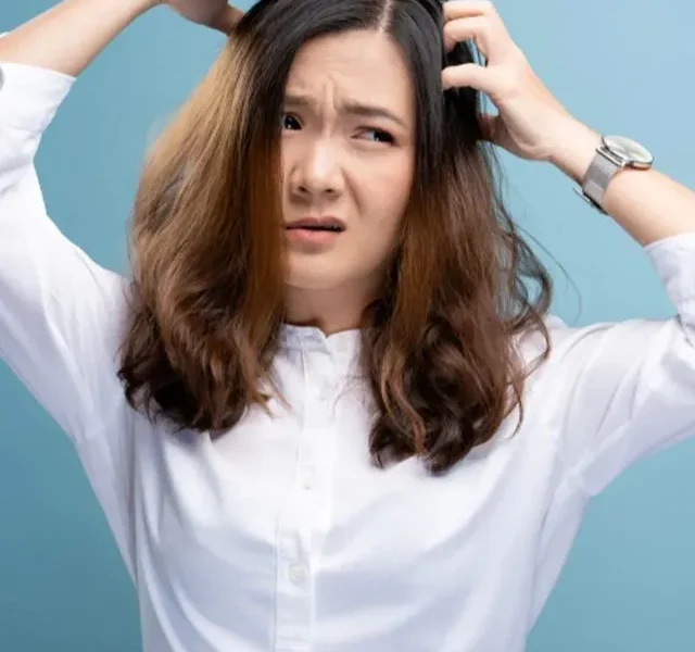 Best Home Remedies For Dandruff