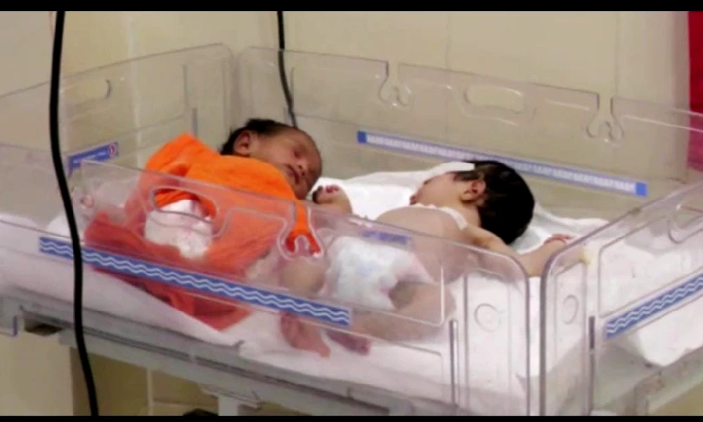 Yadgiri newborn babies were admitted