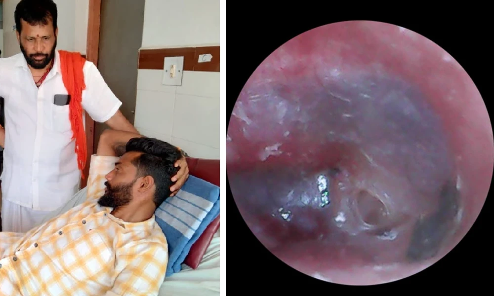 Ear drum torn in Puttur police brutality Puttur News updates
