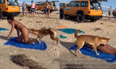 Dog Bite to Woman