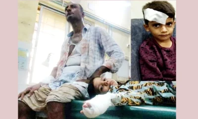 Two boys driver attacked by stray dogs in Bhatkal, Critically injured