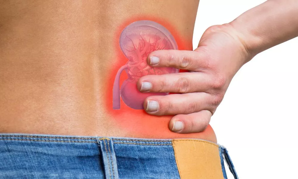 What are the reasons for Kidney Stones