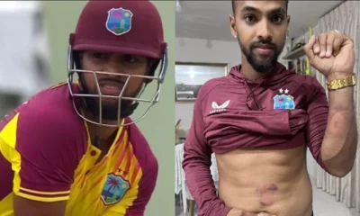 Nicholas Pooran displays his injuries in a social media post, the southpaw in action during the fifth T20I