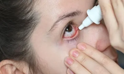 images of Eye Flu Exercises