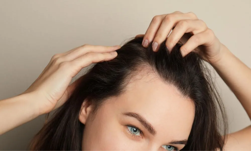 Woman Suffering from Baldness on Grey Background, Closeup