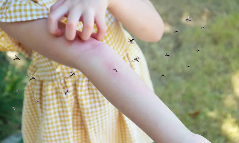 Little girl has skin rash allergy and itchy on her arm from mosq