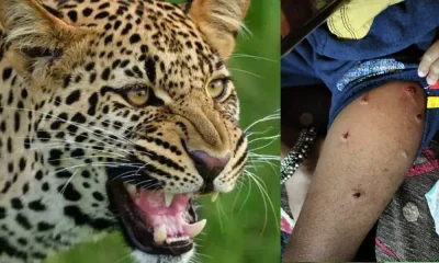Leopard attack on girl
