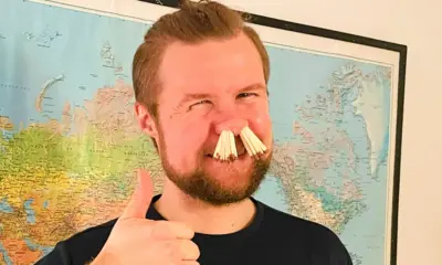 Viral news, 68 Matchsticks in a person nostrils