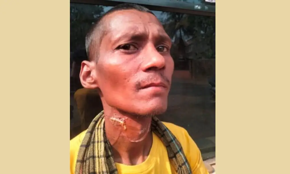 Attempted murder by stabbing a knife in the neck near Manjaguni