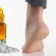 Home Remedy For Cracked Heels