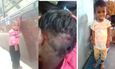 Dog Attack in raichur