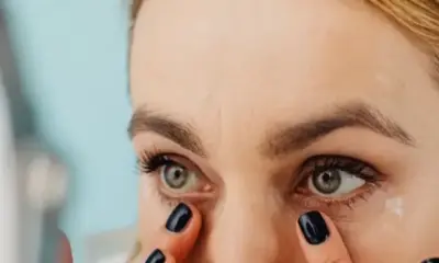 Dark Spots Under Eyes