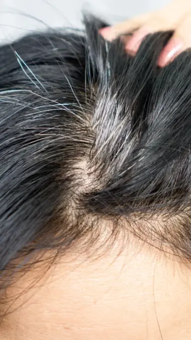 Ways to Prevent Gray Hair