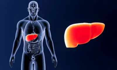 Remedies For Fatty Liver