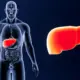 Remedies For Fatty Liver