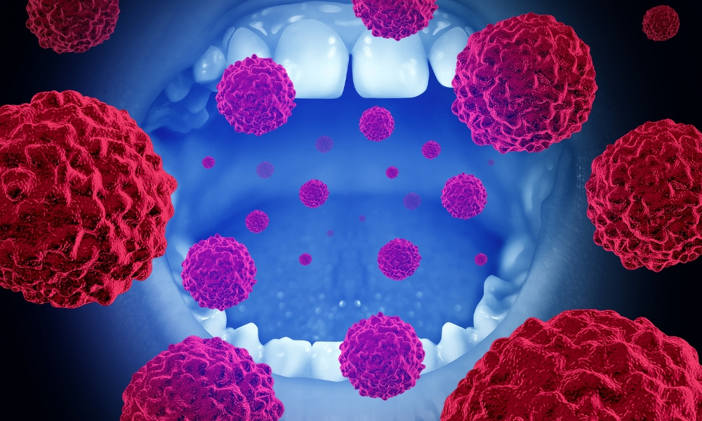 Warning signs of Oral Cancer