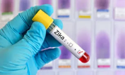 Zika Virus Case