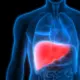 Fatty Liver What Causes